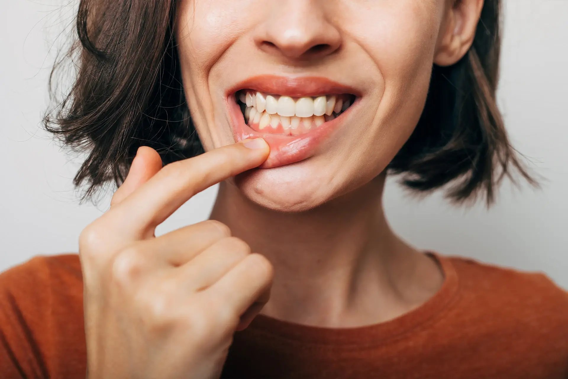Gum Disease Treatment