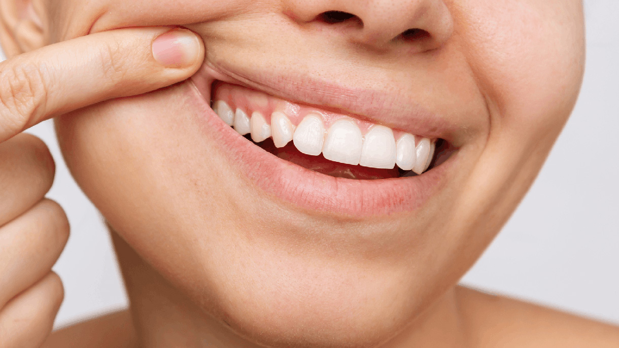 Close up shot of a woman using her finger to pull her upper lip upward, revealing nice healthy gums 