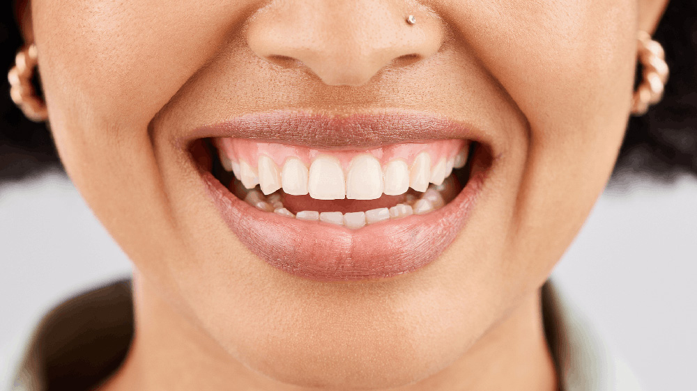 Close up shot of a woman's teeth who is smiling