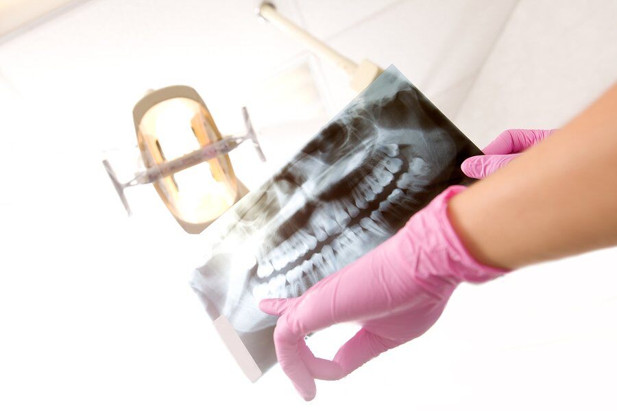 Dental X-rays: 7 of Your Top Questions, Answered!