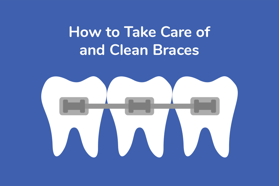 How to Take Care of and Clean Braces