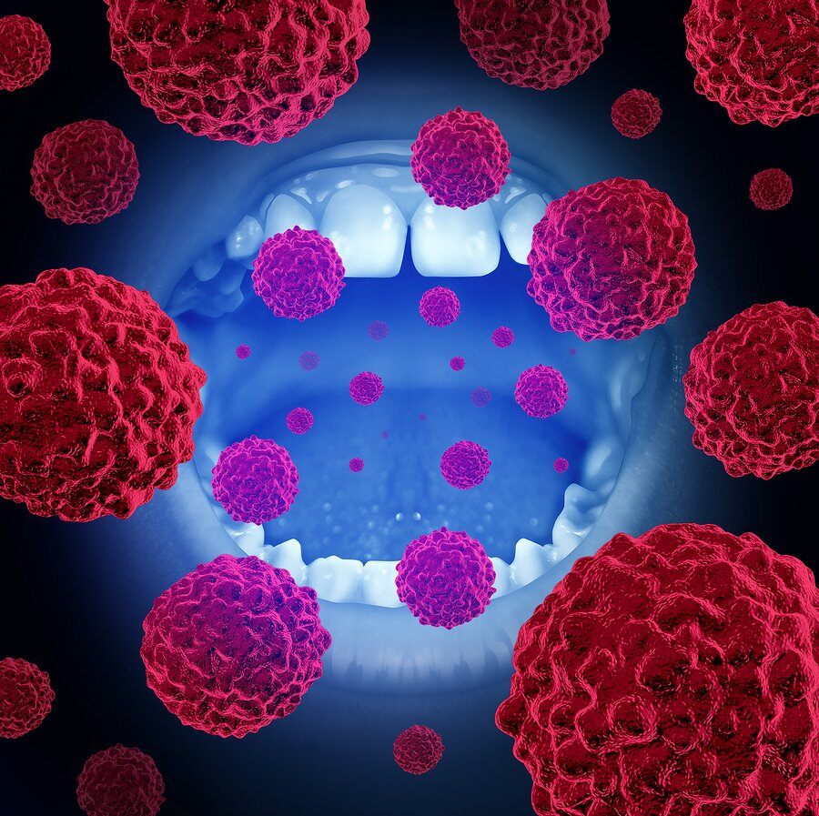 Protect Your Smile: 9 Habits to Prevent Oral Cancer | Gentle Dental
