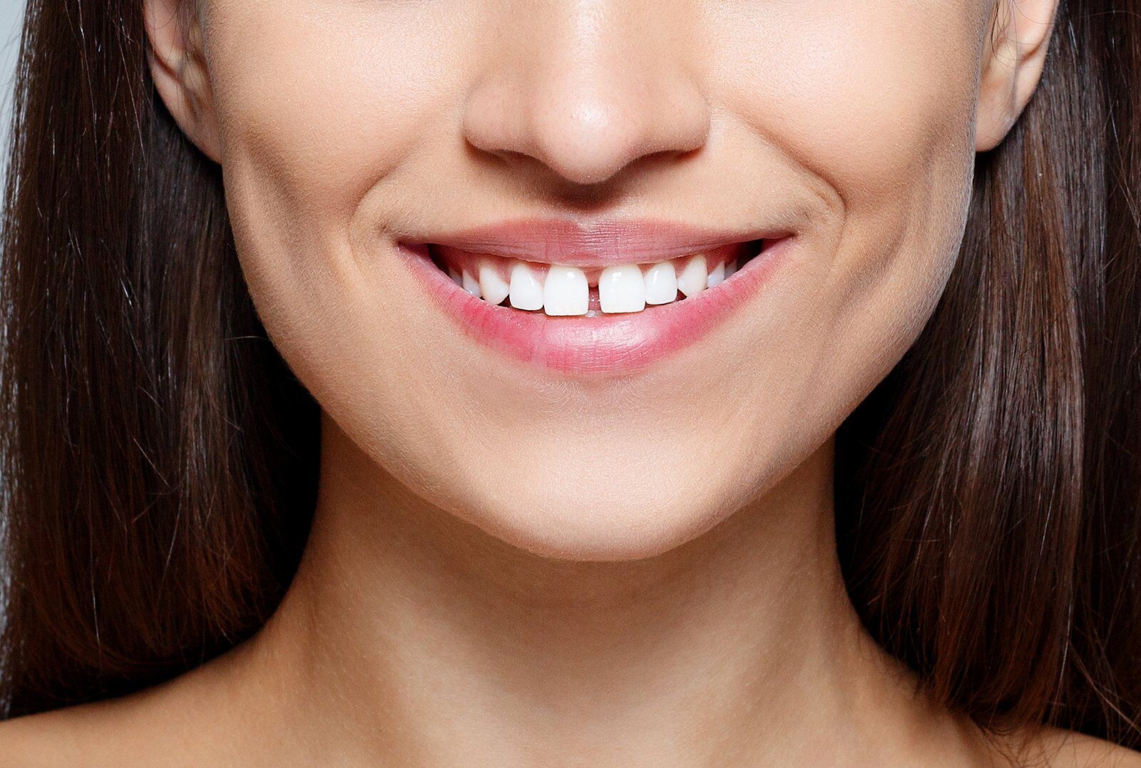 How to Fix a Gap in Your Teeth