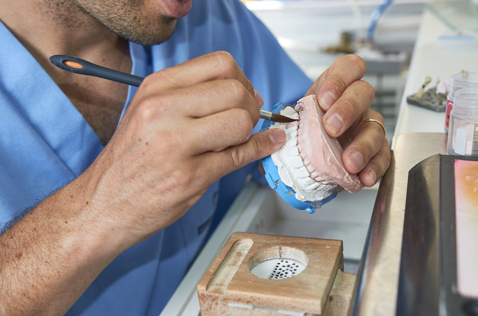 9 Reasons for Choosing Ceramic Crowns