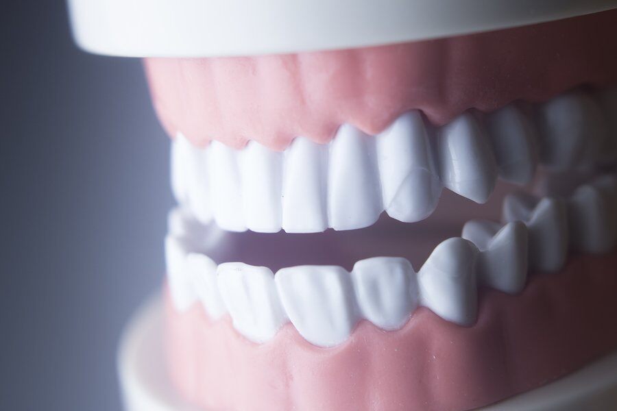 Gum Recession Explained: Causes and Prevention Methods