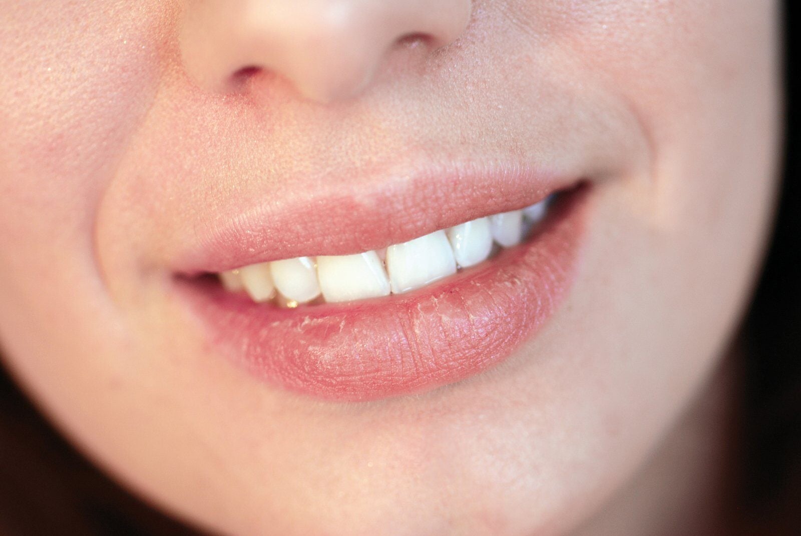 What Causes Dry Mouth? Symptoms & Side Effects Explained
