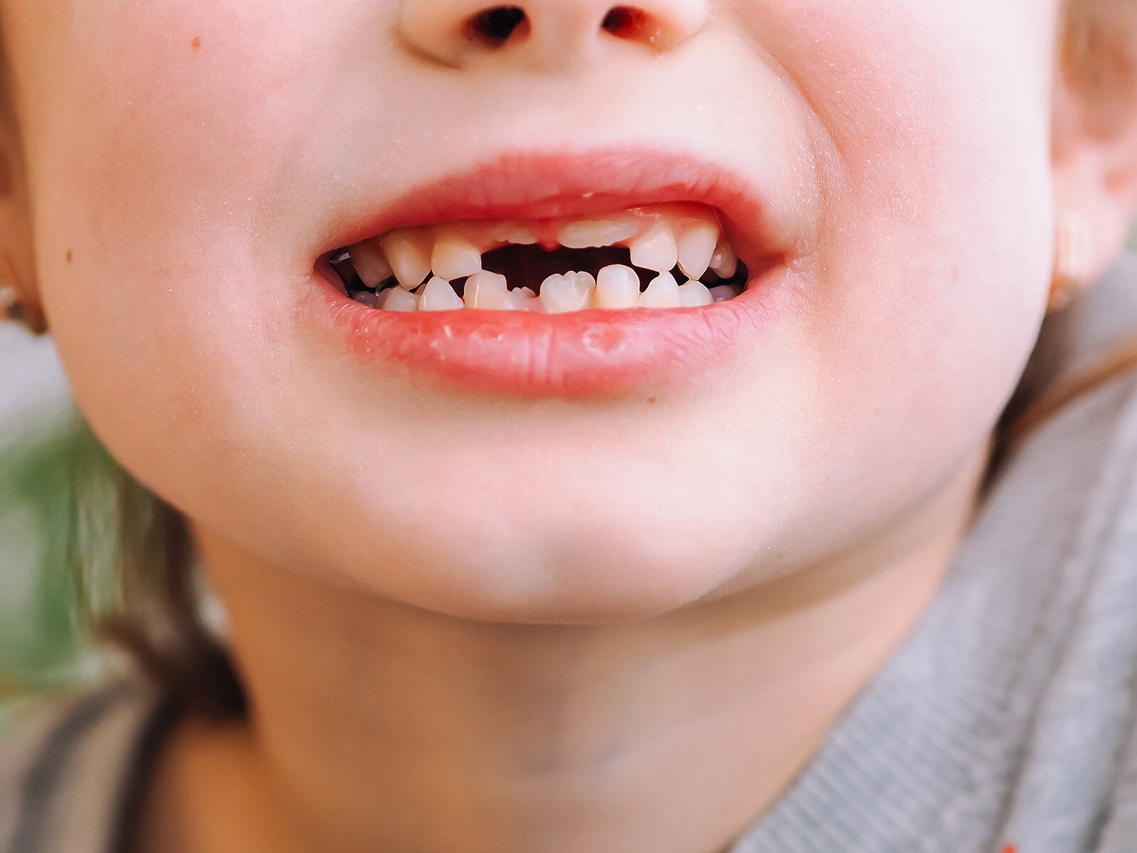 When You Should Expect Your Child’s Teeth to Come in and Fall Out