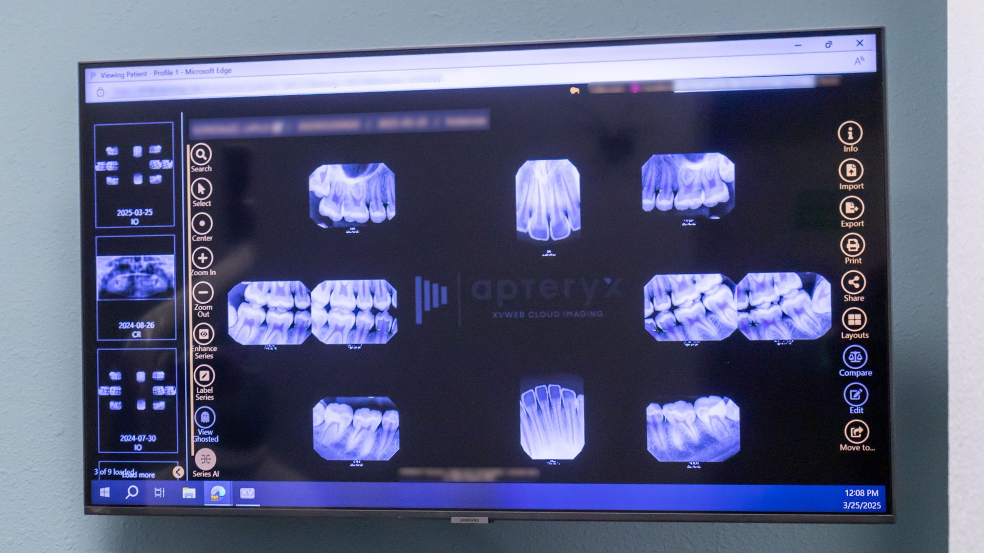 general-dentist-xray-shot_Gentle-Dental-Perris